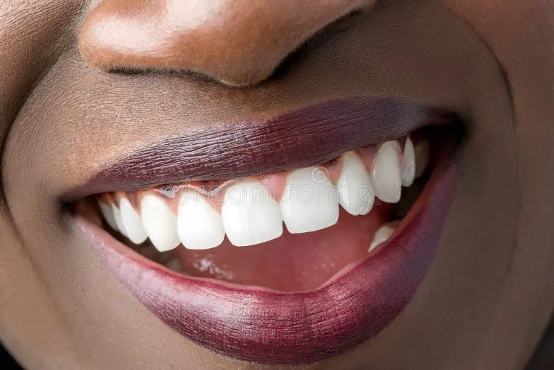 Sourire avec des dents blanches