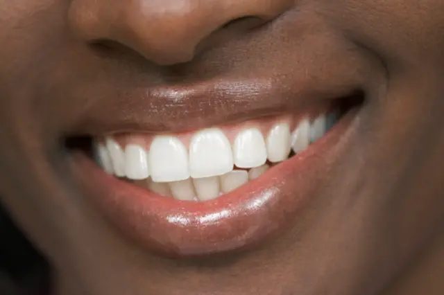 Dents blanches et brillantes